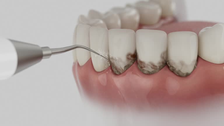 Trusted Teeth Cleaning And Checkup service in Claxton, GA - Dentist Open Now